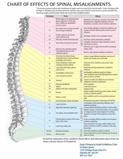 Spinal Misalignment Chart